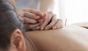 acupuncture appointment