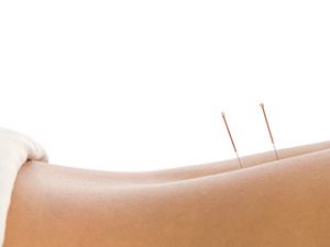 Acupuncture