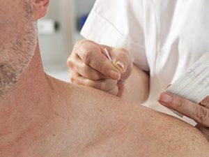 Sports acupuncture